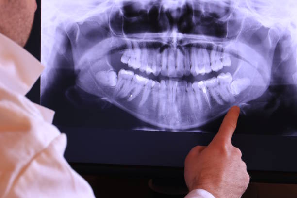 Best Emergency Dentist for Lost Fillings or Crowns in Montgomery, GA